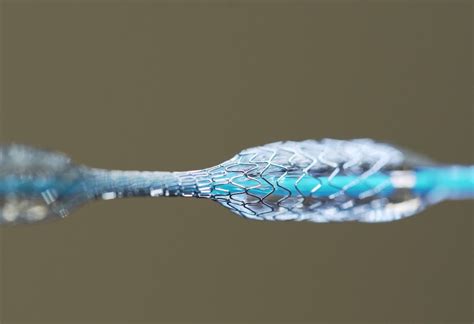 Nitinol: Une merveille des métaux pour l'ingénierie biomédicale et les dispositifs actifs ?